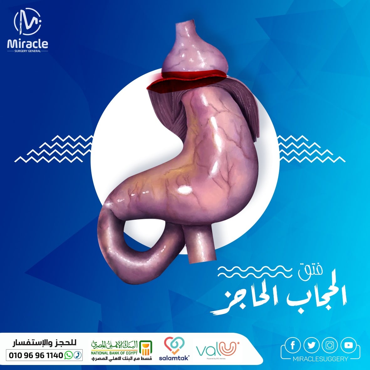 هل يلتئم فتق الحجاب الحاجز؟