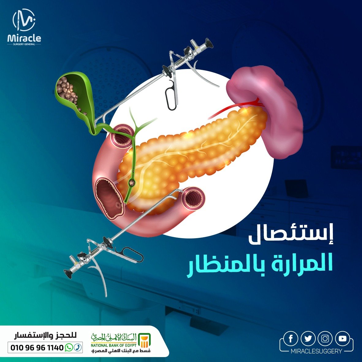 تجربتي مع استئصال المرارة بالمنظار