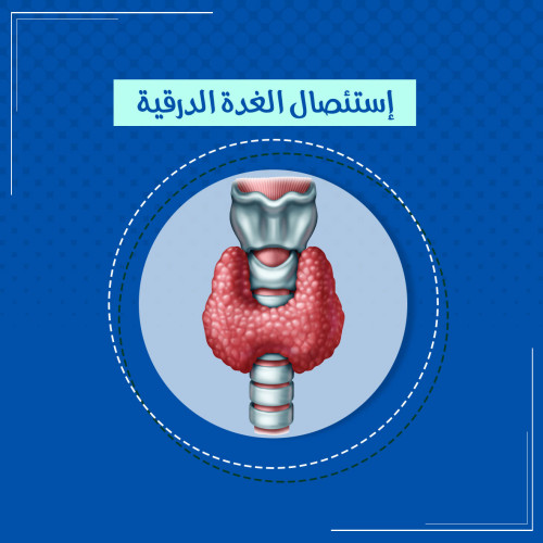 استئصال الغدة الدرقيه